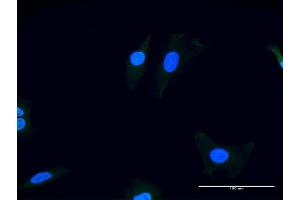 Immunofluorescence of purified MaxPab antibody to ITGAV on HeLa cell. (CD51 抗体  (AA 1-1048))