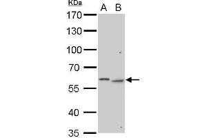 Western Blotting (WB) image for anti-Galactosamine (N-Acetyl)-6-Sulfate Sulfatase (GALNS) (Center) antibody (ABIN2856743)