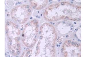 IHC-P analysis of Human Kidney Tissue, with DAB staining. (TRPC6 抗体  (AA 1-192))