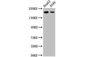 Western Blot Positive WB detected in: HepG2 whole cell lysate, A549 whole cell lysate All lanes: LRRK1 antibody at 3 μg/mL Secondary Goat polyclonal to rabbit IgG at 1/50000 dilution Predicted band size: 226, 29 kDa Observed band size: 226 kDa (LRRK1 抗体  (AA 1-68))
