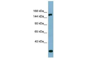 EPRS antibody used at 1 ug/ml to detect target protein. (EPRS 抗体  (Middle Region))
