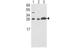 Western Blotting (WB) image for anti-rho GDP Dissociation Inhibitor (GDI) alpha (ARHGDIA) antibody (ABIN3001701) (ARHGDIA 抗体)