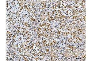 IHC analysis of NF1 using anti-NF1 antibody (ABIN7600195).