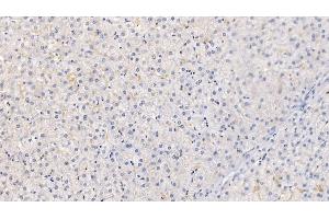 Detection of CRAT in Human Liver Tissue using Polyclonal Antibody to Carnitine Acetyltransferase (CRAT) (CRAT 抗体  (AA 363-626))