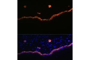 Immunofluorescence analysis of rat skin using Cytokeratin 15 (KRT15) (KRT15) Rabbit mAb (ABIN7268093) at dilution of 1:100 (40x lens). (KRT15 抗体)