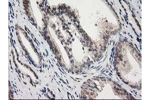Image no. 9 for anti-Protein Kinase C, epsilon (PRKCE) antibody (ABIN1500229)