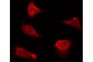 ABIN6267385 staining 293 by IF/ICC. (Ezrin 抗体  (pTyr478))