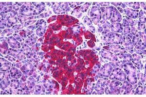 Human Pancreas, Islets of Langerhans: Formalin-Fixed, Paraffin-Embedded (FFPE) (Glutamic Acid Decarboxylase 抗体  (AA 545-594))