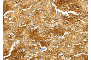 ABIN6265356 and ABIN6277579 at 1/100 staining Rat brain tissue by IHC-P. (STXBP1 抗体  (C-Term))