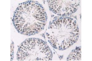 IHC-P analysis of Mouse Testis Tissue, with DAB staining. (SERPING1 抗体  (AA 397-495))
