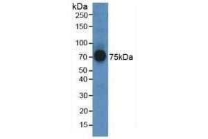 Detection of AFM in Human Serum using Polyclonal Antibody to Afamin (AFM) (Afamin 抗体  (AA 211-403))