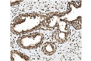 IHC analysis of TET1 using anti TET1 antibody (ABIN7600442). (TET1 抗体  (AA 194-417))