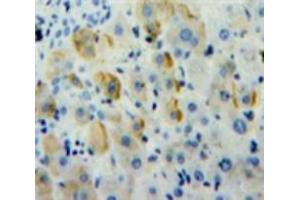 Used in DAB staining on fromalin fixed paraffin-embedded Liver tissue (alpha 1 Adrenergic Receptor 抗体  (AA 330-466))
