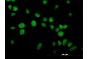 Immunofluorescence of monoclonal antibody to USP14 on HeLa cell. (USP14 抗体  (AA 395-494))