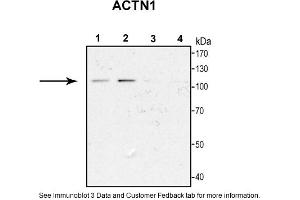 Sample Type: 1. (ACTN1 抗体  (N-Term))