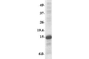 Western Blotting (WB) image for Myeloid Differentiation Primary Response Gene (88) (MYD88) (AA 176-280) protein (His tag,Strep II tag) (ABIN2468874)