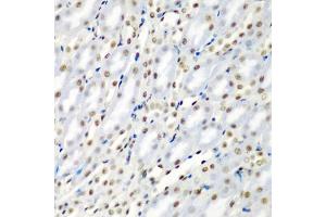Immunohistochemistry of paraffin-embedded mouse kidney using SF3B3/S antibody (ABIN6128696, ABIN6147668, ABIN6147669 and ABIN6221751) at dilution of 1:200 (40x lens). (SF3B3 抗体  (AA 948-1217))