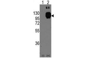 Image no. 1 for anti-Cadherin 13 (CDH13) (C-Term) antibody (ABIN356921) (Cadherin 13 抗体  (C-Term))