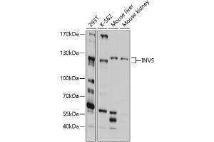 Western blot analysis of extracts of various cell lines, using INVS antibody (ABIN6129042, ABIN6142498, ABIN6142499 and ABIN6214498) at 1:1000 dilution. (Inversin 抗体  (AA 1-90))