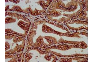 IHC image of ABIN7175101 diluted at 1:200 and staining in paraffin-embedded human prostate tissue performed on a Leica BondTM system. (SLC14A1 抗体  (AA 1-51))