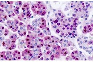 Human Pancreas: Formalin-Fixed, Paraffin-Embedded (FFPE)