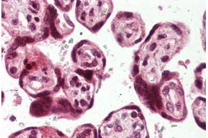 Placenta, Human: Formalin-Fixed, Paraffin-Embedded (FFPE) (USP2 抗体  (C-Term))