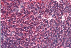 Human Tonsil: Formalin-Fixed, Paraffin-Embedded (FFPE) (BIRC3 抗体  (AA 314-508))