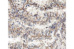 IHC analysis of IMPDH1 using anti-IMPDH1 antibody (ABIN7599864).