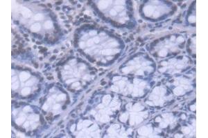 DAB staining on IHC-P; Samples: Mouse Colon Tissue (HNRNPA1 抗体  (AA 2-320))
