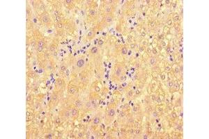 Immunohistochemistry of paraffin-embedded human liver tissue using ABIN7160996 at dilution of 1:100 (ME1 抗体  (AA 161-519))