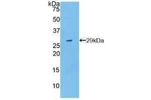 Detection of Recombinant PARP, Mouse using Polyclonal Antibody to Poly ADP Ribose Polymerase (PARP) (PARP1 抗体  (AA 661-881))