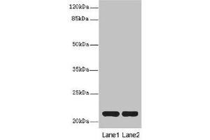 Western blot All lanes: CXXC4antibody at 3. (CXXC4 抗体  (AA 1-198))