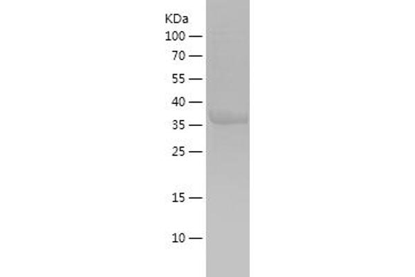 ADAM17 Protein (AA 752-824) (His-IF2DI Tag)