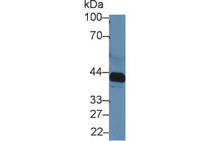 Western blot analysis of Rat Serum, using Rat IL6R Antibody (5 µg/ml) and HRP-conjugated Goat Anti-Rabbit antibody ( (IL-6 Receptor 抗体  (AA 214-348))
