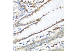 Immunohistochemistry of paraffin-embedded human stomach using CAD antibody. (CAD 抗体  (AA 1650-1900))
