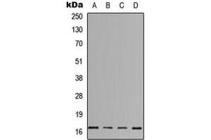 Western blot analysis of IL-3 expression in HeLa (A), Jurkat (B), Raw264. (IL-3 抗体  (Center))