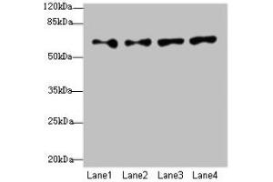 Western blot All lanes: CFAP52 antibody at 4 μg/mL Lane 1: HepG2 whole cell lysate Lane 2: K562 whole cell lysate Lane 3: U937 whole cell lysate Lane 4: A549 whole cell lysate Secondary Goat polyclonal to rabbit IgG at 1/10000 dilution Predicted band size: 69, 70, 61 kDa Observed band size: 69 kDa (WDR16 抗体  (AA 101-400))