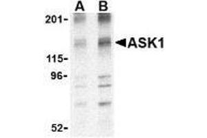Western blot analysis of ASK1 in 3T3 cell lysate with AP30087PU-N ASK1 antibody at (A) 1 and (B) 2 μg/ml. (ASK1 抗体  (N-Term))