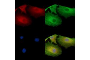 NCE2 Antibody staining A549 cells by IF/ICC. (UBE2F 抗体)