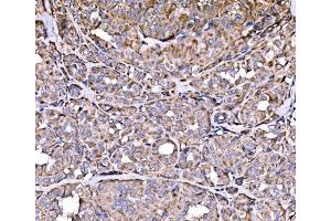 IHC analysis of RPL17 using anti-RPL17 antibody (ABIN7601639). (RPL17 抗体  (AA 40-167))