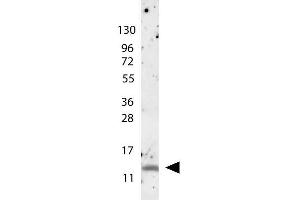 anti-Human MIP-1ß antibody shows detection of a band ~15 kDa in size corresponding to recombinant human MIP-1ß.