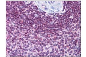 Immunohistochemistry (Paraffin-embedded Sections) (IHC (p)) image for anti-Hydrogen Voltage-Gated Channel 1 (HVCN1) (C-Term) antibody (ABIN784098)