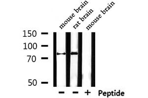Western blot analysis of extracts from mouse brain,rat brain, using Mitofusin Antibody. (MFN1 抗体  (Internal Region))