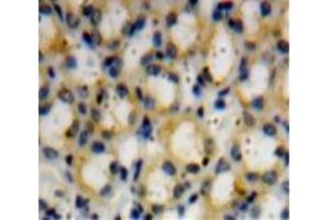 Used in DAB staining on fromalin fixed paraffin-embedded Kidney tissue (Dymeclin 抗体  (AA 546-669))