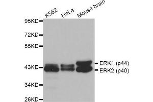Western blot analysis of extracts of various cell lines, using ERK1/2 antibody. (ERK2 抗体  (AA 200-300))
