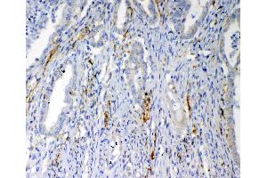 Immunohistochemistry (IHC) image for anti-C-Fos Induced Growth Factor (Vascular Endothelial Growth Factor D) (Figf) (AA 89-205) antibody (ABIN3044524)