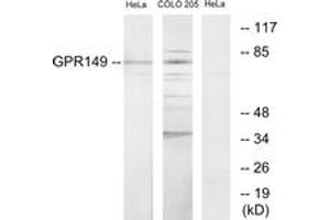 Western blot analysis of extracts from HeLa/COLO205 cells, using GPR149 Antibody. (GPR149 抗体  (AA 451-500))