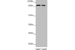 Western blot All lanes: CEP95 antibody at 6. (CEP95 抗体  (AA 582-821))