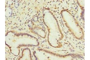 Immunohistochemistry of paraffin-embedded human pancreatic tissue using ABIN7146772 at dilution of 1:100 (CPD 抗体  (AA 860-1100))