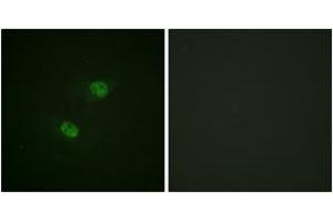 Immunofluorescence analysis of HeLa cells, using CDC16/APC6 (Phospho-Ser560) Antibody. (CDC16 抗体  (pSer560))